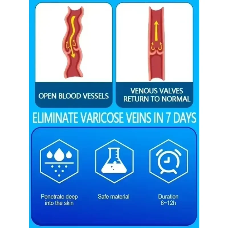 Rivelare le gambe stanche e doloranti |   Laser medico per vene varicose e ragno |   Stimolare il flusso sanguigno: anche sulle pelli sensibili