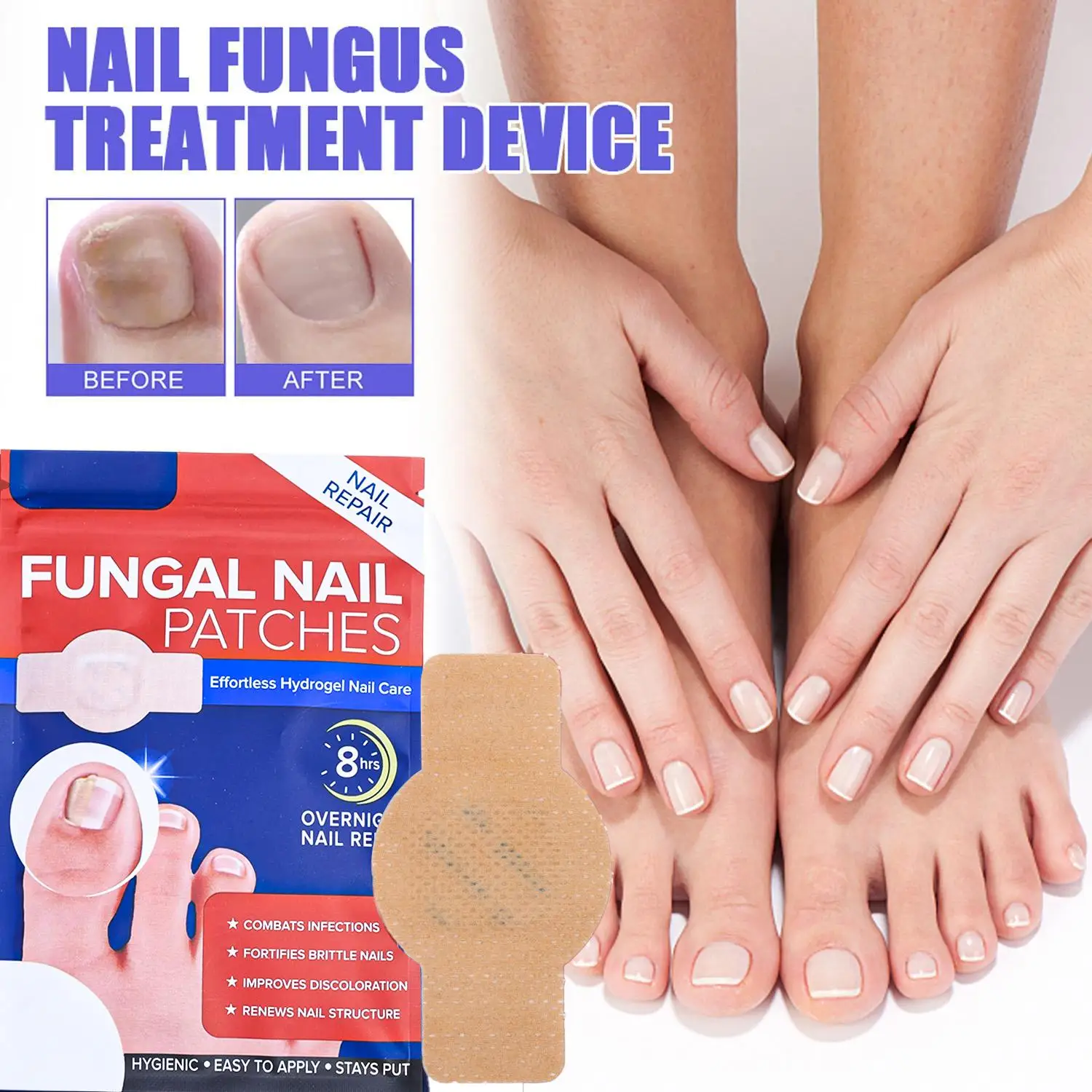 21 Adesivos para Reparo de Unhas, Adesivo para Fungos nas Unhas dos Pés, Ferramentas de Cuidado Adesivas, Adesivo Corretor de Unha Encravada, Adesivo Descartável para Paroníquia