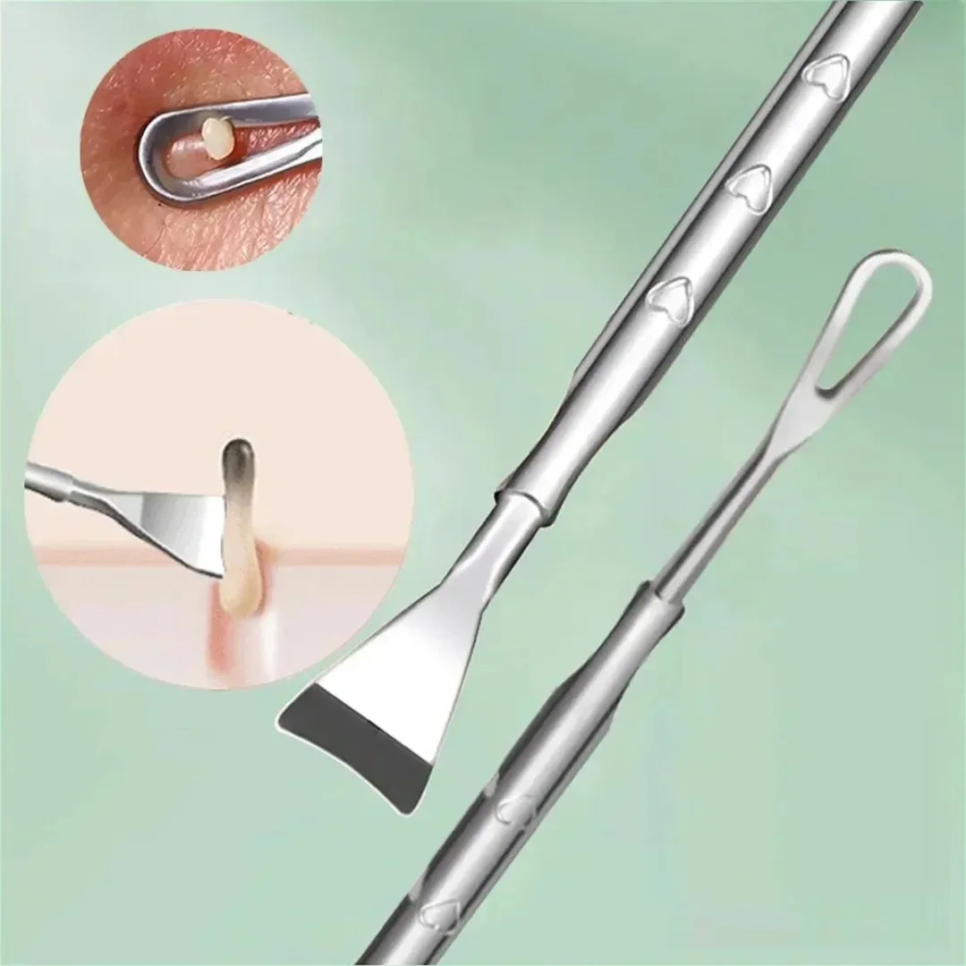 NEUE Mitesser Entferner Pickel Popper Werkzeug Akne Nadel Entfernen Behandlung Whitehead Popping Gesicht Makel Extractor Hautpflege Werkzeuge