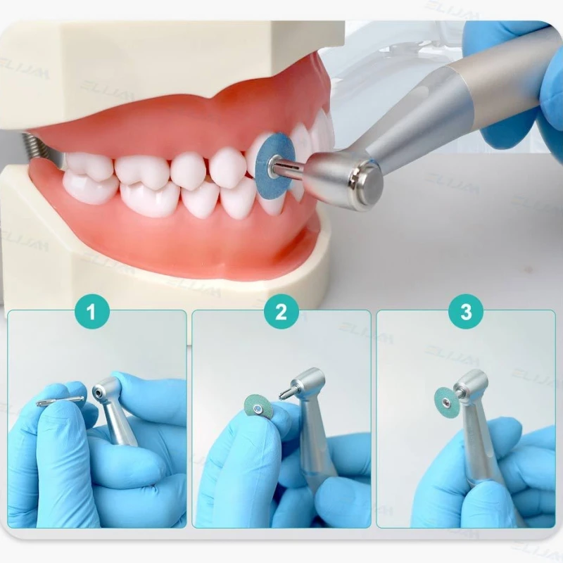 Discos de pulido Dental, mandril de contorno de reducción bruto, disco flexible Soflex, vástago RA, acabado Dental para restauración de compuestos