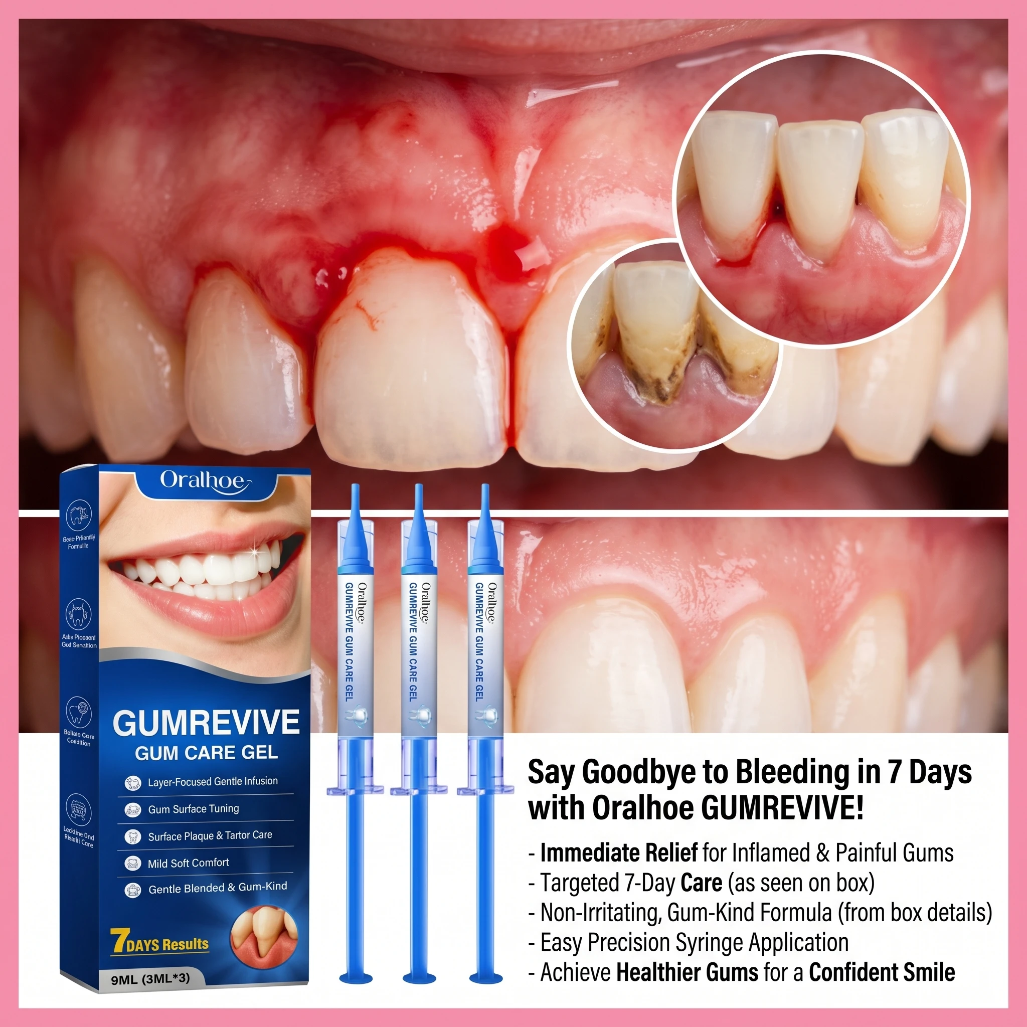 Gumrevive Gum Care Gel Deep Cleaning Periodontal Repair Gel For Plaque Tartar Gum Health Instant Fresh Feeling Oral Care