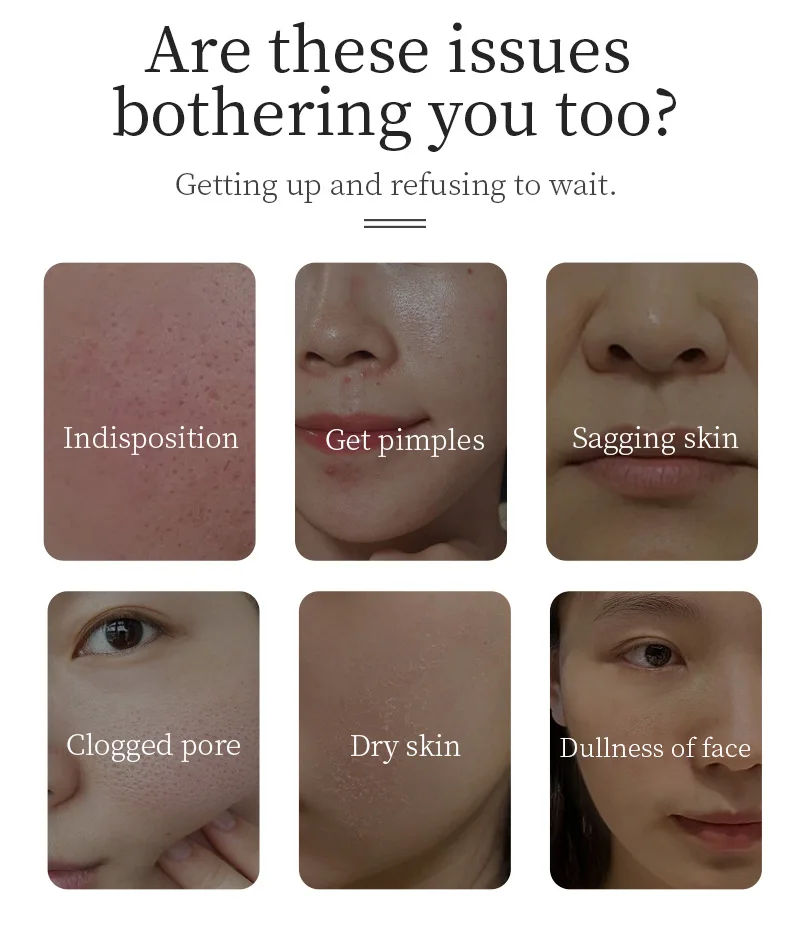 Pluma de burbuja de oxígeno de mano, pluma de burbuja de CO2, dispositivo de cuidado de la piel Facial, cepillo de limpieza Facial, terapia de luz LED, Spa