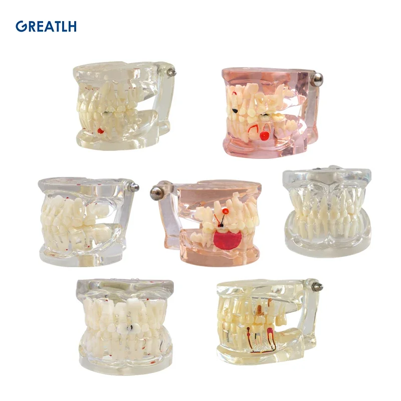 Dental Teeth Model for Dentist Teaching Clear Primary Teeth Model Mixed Age with Pathology Model Dental Materials