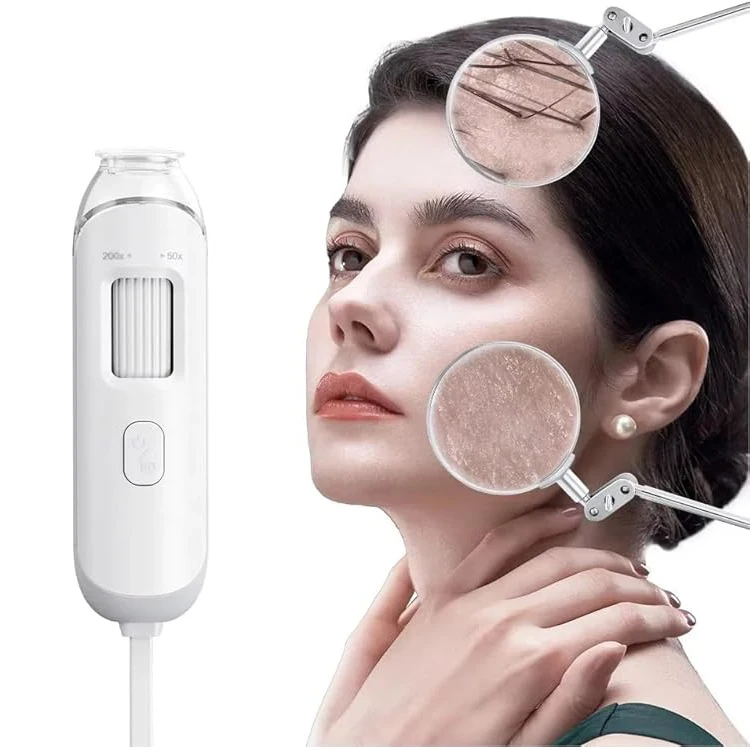 

Перезаряжаемый ручной детектор кожи головы, сканер кожи, анализатор кожи, анализ кожи головы, фолликулы, детектор кожи головы