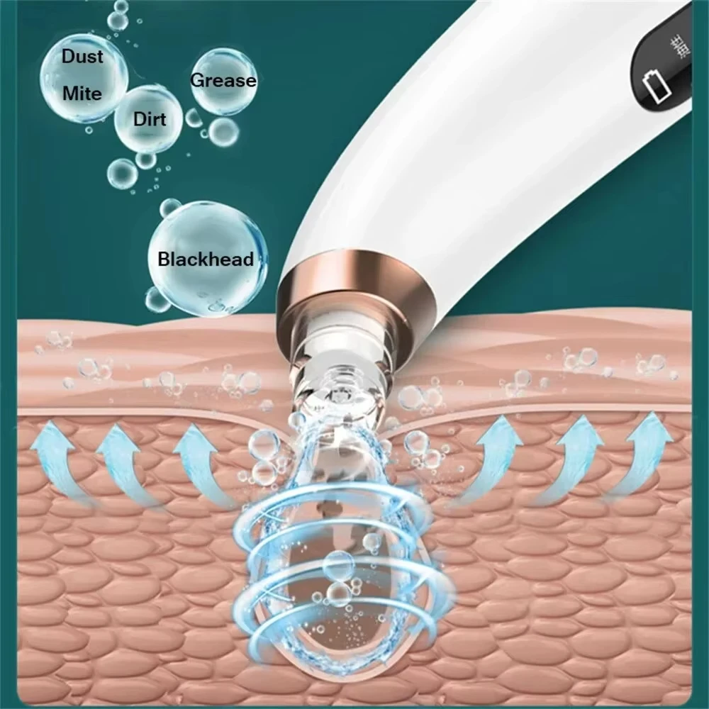 電気にきび除去剤,小さな泡,USB,水循環,毛穴,にきび,にきび除去,真空吸引,鼻掃除機