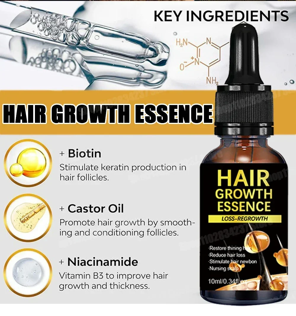 نمو الشعر للرجال والنساء، منتجات سريعة النمو، الزيوت الأساسية، الزنجبيل المضادة لتساقط الشعر، فروة الرأس، العناية بالشعر