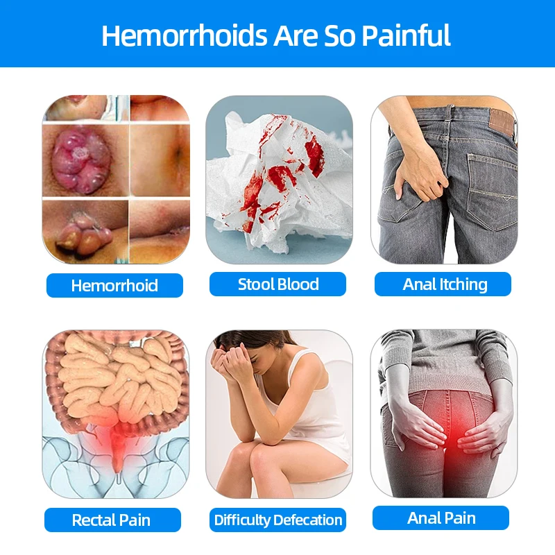 Hemorrhoids Treatment Medical Navel Plaster Anal Swell Bleed Cure Internal External Mixed Hemorrhoid Removal Patch CFDA Approve