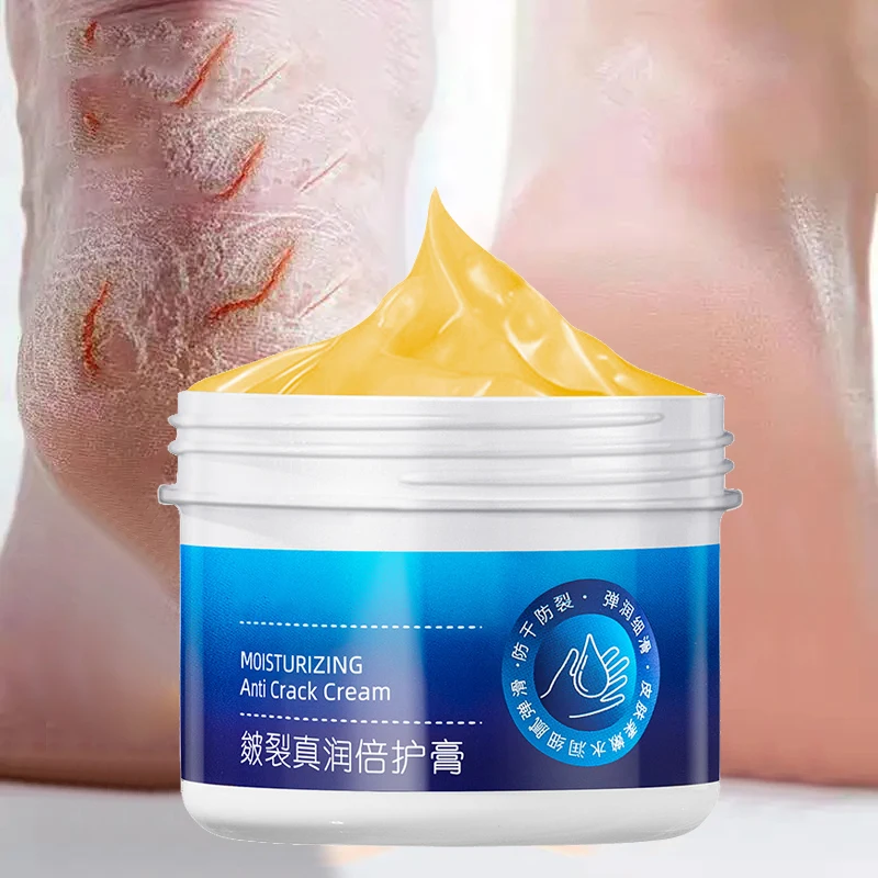 Anti-Trocknungs-Riss Hand Fußpflege Creme Ferse rissige Reparatur produkte Entfernung abgestorbene Haut feuchtigkeit spendende Bleaching nähren Hautpflege