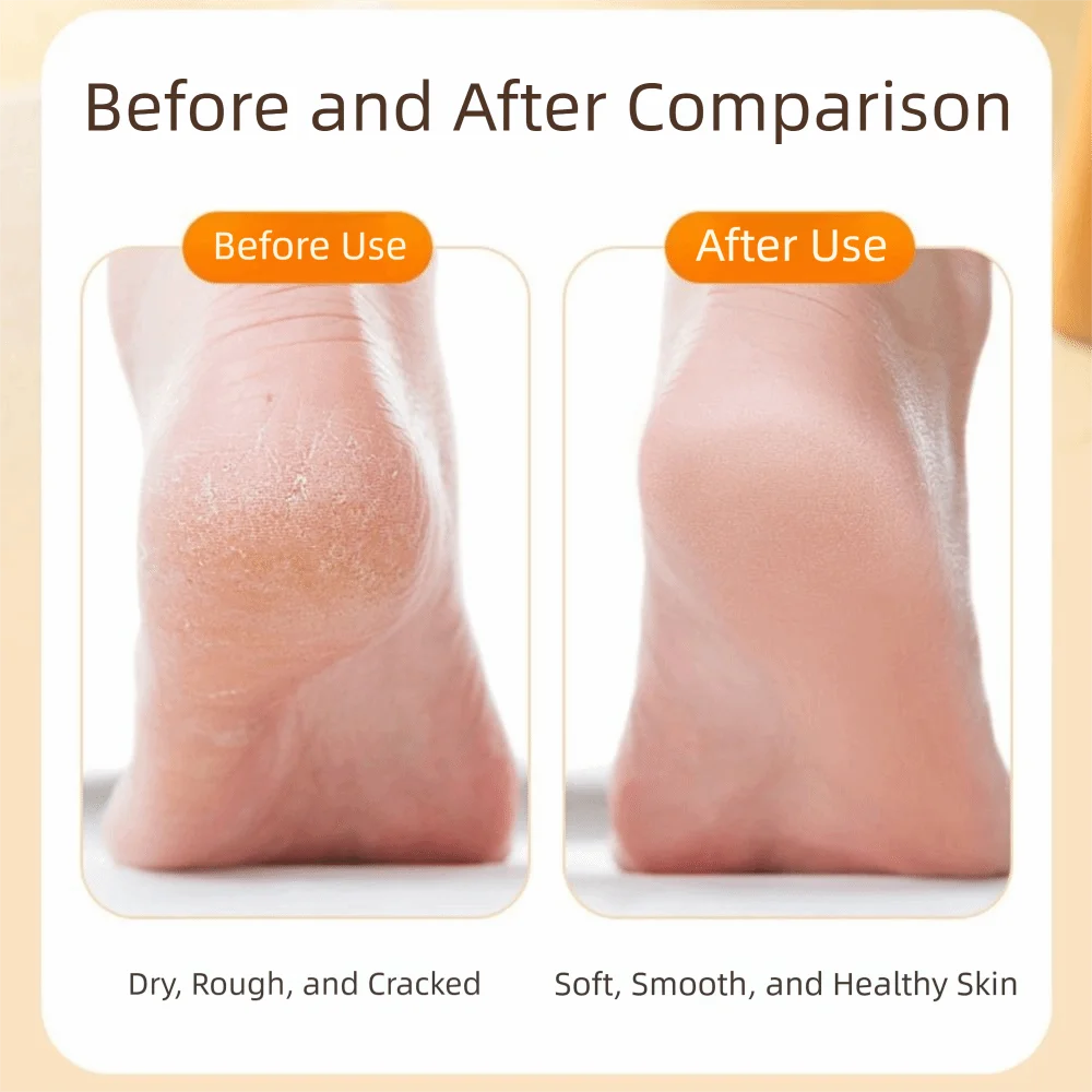 

Набор из 10 двусторонних деревянных пилок для ног с отверстием для подвешивания, нескользящей ручкой, для удаления мозолей, водонепроницаемые, для влажного и сухого использования