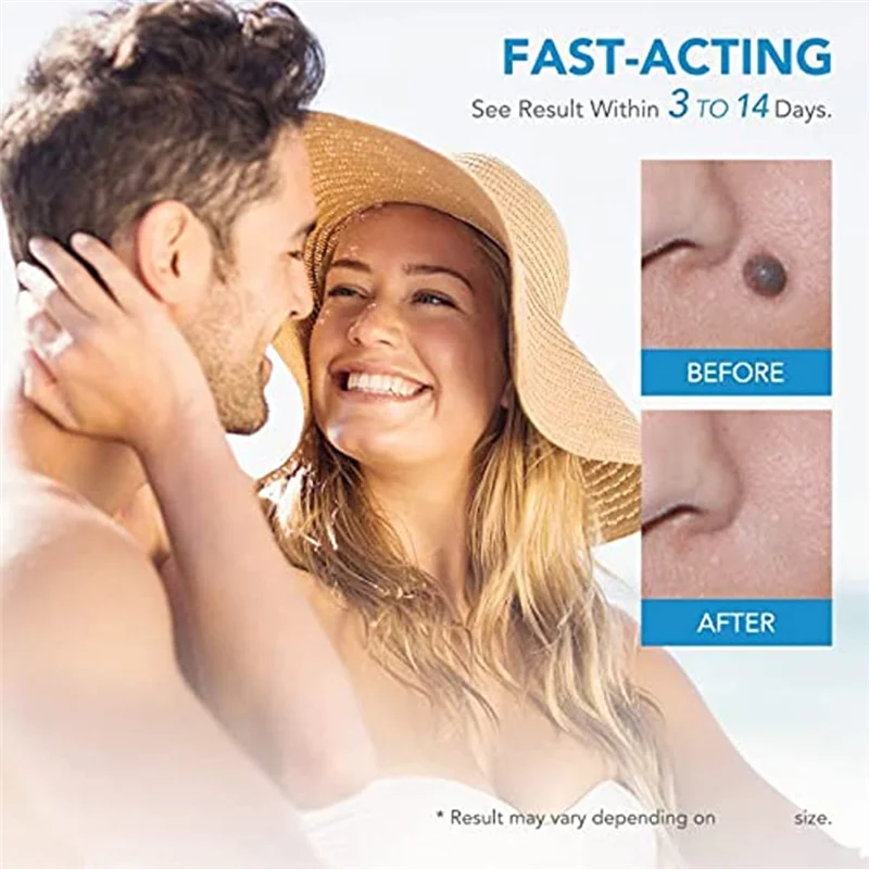 Best 2 In1 Painless Auto Skin Tag Mole Wart Removal Kit Skin Care Body Wart Dot Treatments Remover Cleaning Tools