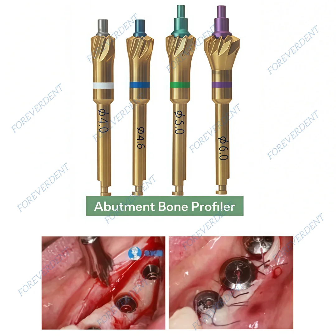 

Стоматологический шлифовальный бор, универсальный костный профилер для имплантатов с пилотной дрелью, хирургический инструмент для укладки имплантатов