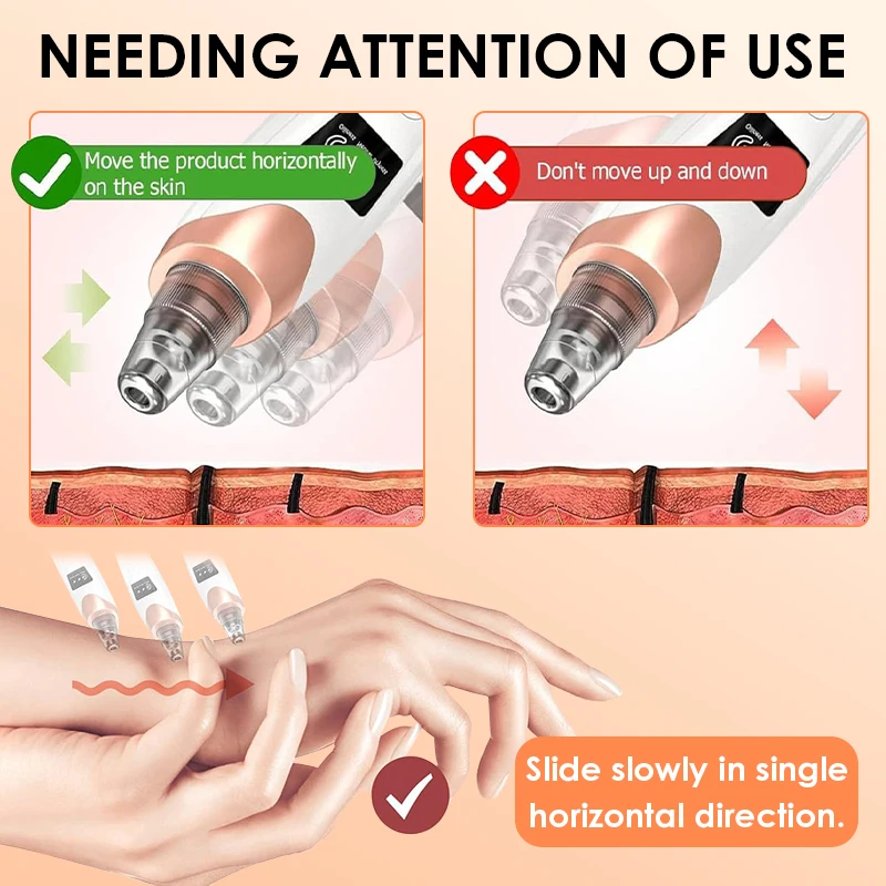 Blackhead Remover Pore Vacuum Face Cleaner Electric USB Recharge Pore Cleaner Spot Acne Pimple Black Head Deep Skin Care Beauty