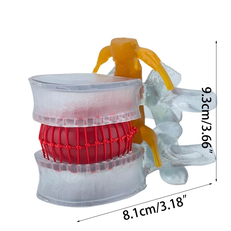 Anatomical-Lumbar Spine Model Movable Lumbar Disc Human Lumbar Vertebrae Model 4th Lumbar Vertebra 5th Lumbar Dropshipping