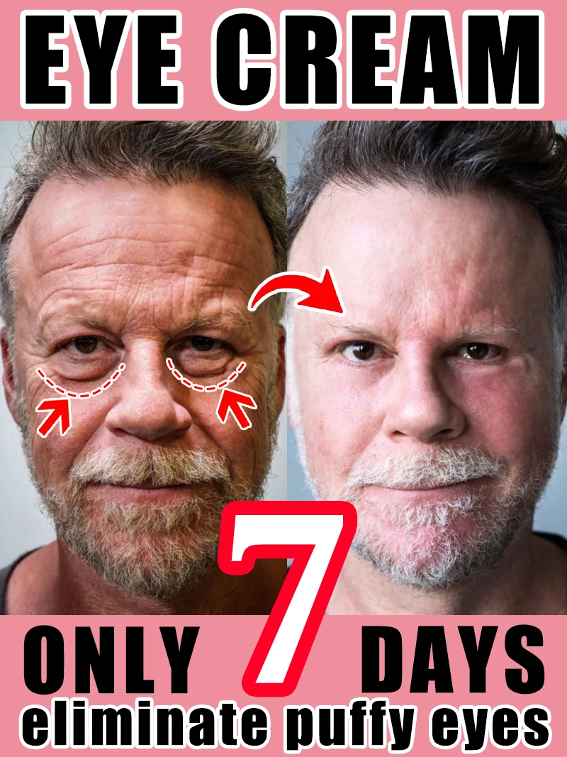 

eye cream for dark and puffy eyes