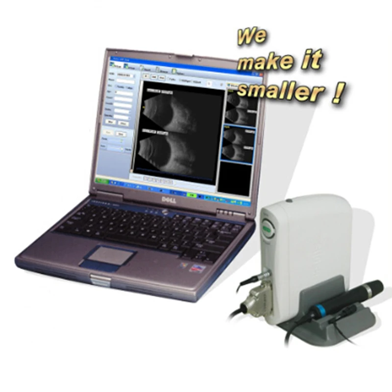 SW2100 USB ultrasound diagnostic ophthalmic a&b scan machine