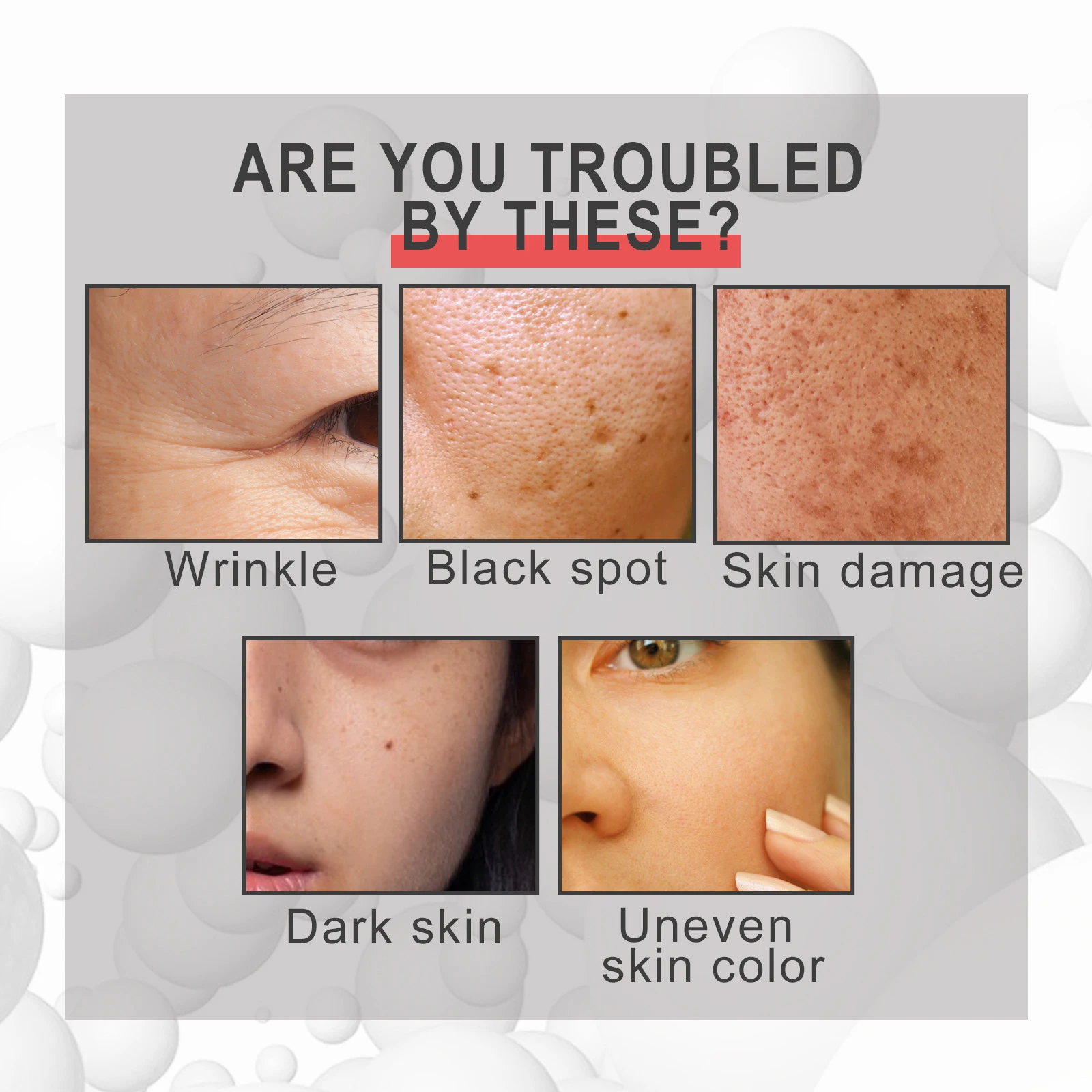 30Ml Collageen Anti-Rimpelcrème Ruwheid Verbetering Crème Voor Rimpels En Acne Bestrijden