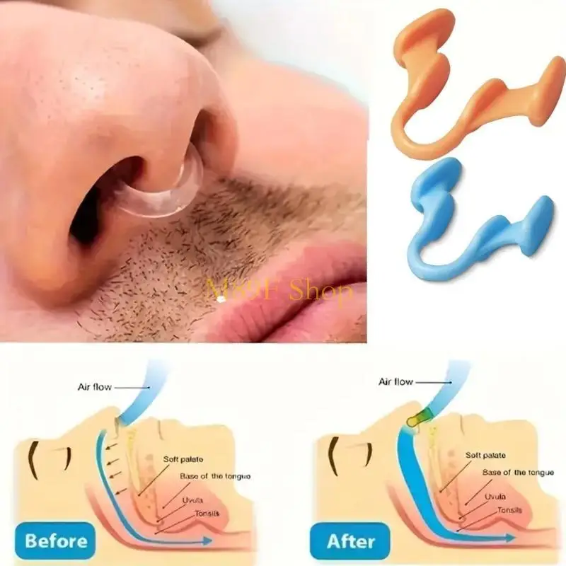 M89F 6Pcs Nose Stop Clip Nose Nasal Stopper Clip Plastic Anti Snoring Nose Clip for Accidental or Emergency Condition
