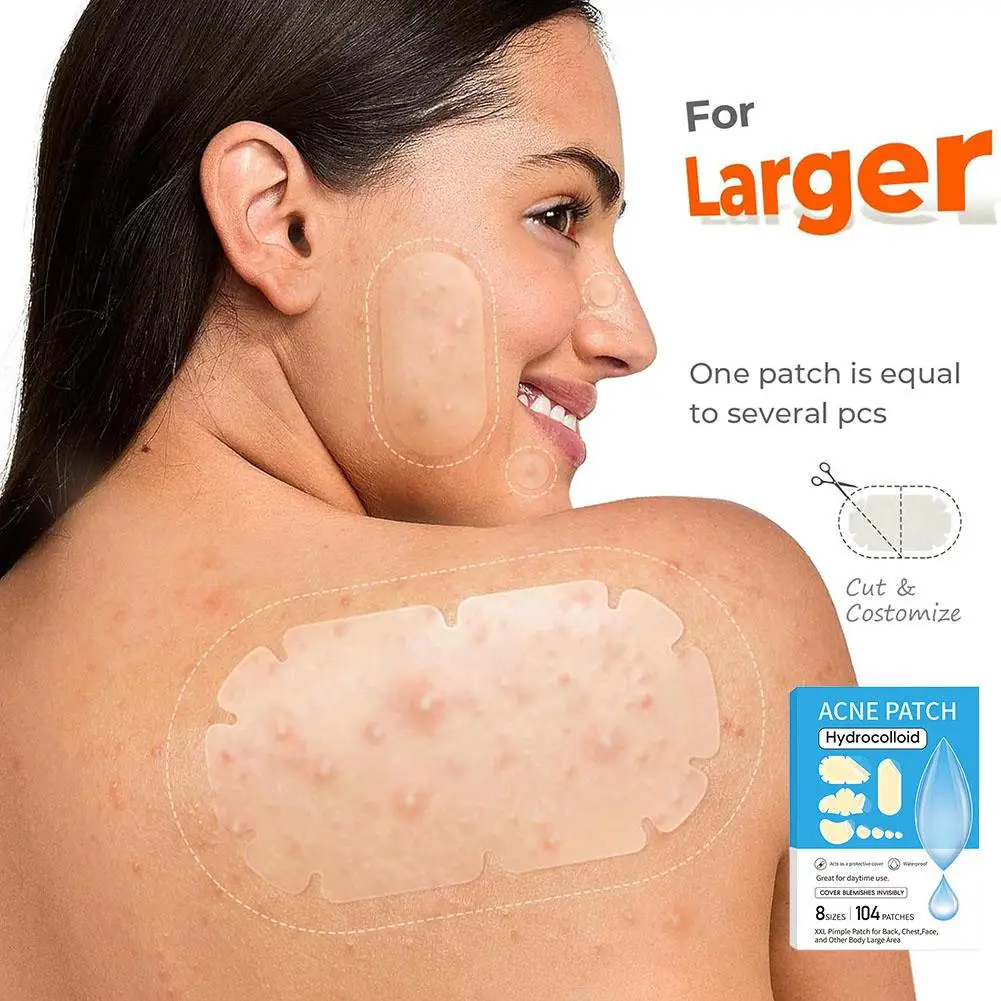 Large Pimple Patches Bulk For Face Hydrocolloid Multi-shape Invisible Removal Acne Patches Covering Body Forehead Chin Blemishes