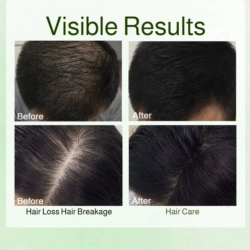 Natural Usman Shampoo Refreshing Oil-controlling And Itching-relieving Softening And Plump Hair To Improve Hair Loss - Image 6