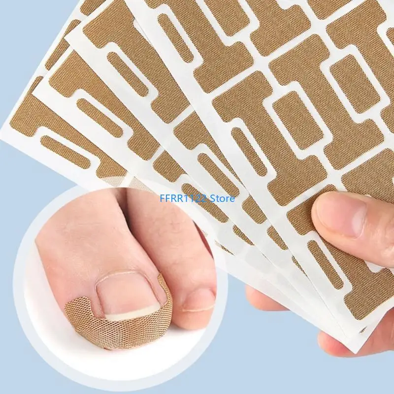 y1uf 10 pcs أظافر تصحيح بقع تصحيح أظافر الصعود التنفس