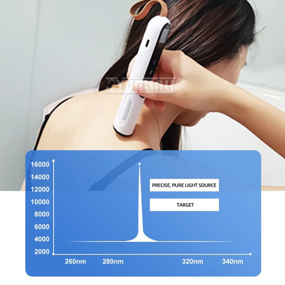 Hand-Held 308nm UVB Phototherapy Light For Vitiligo Psoriasis