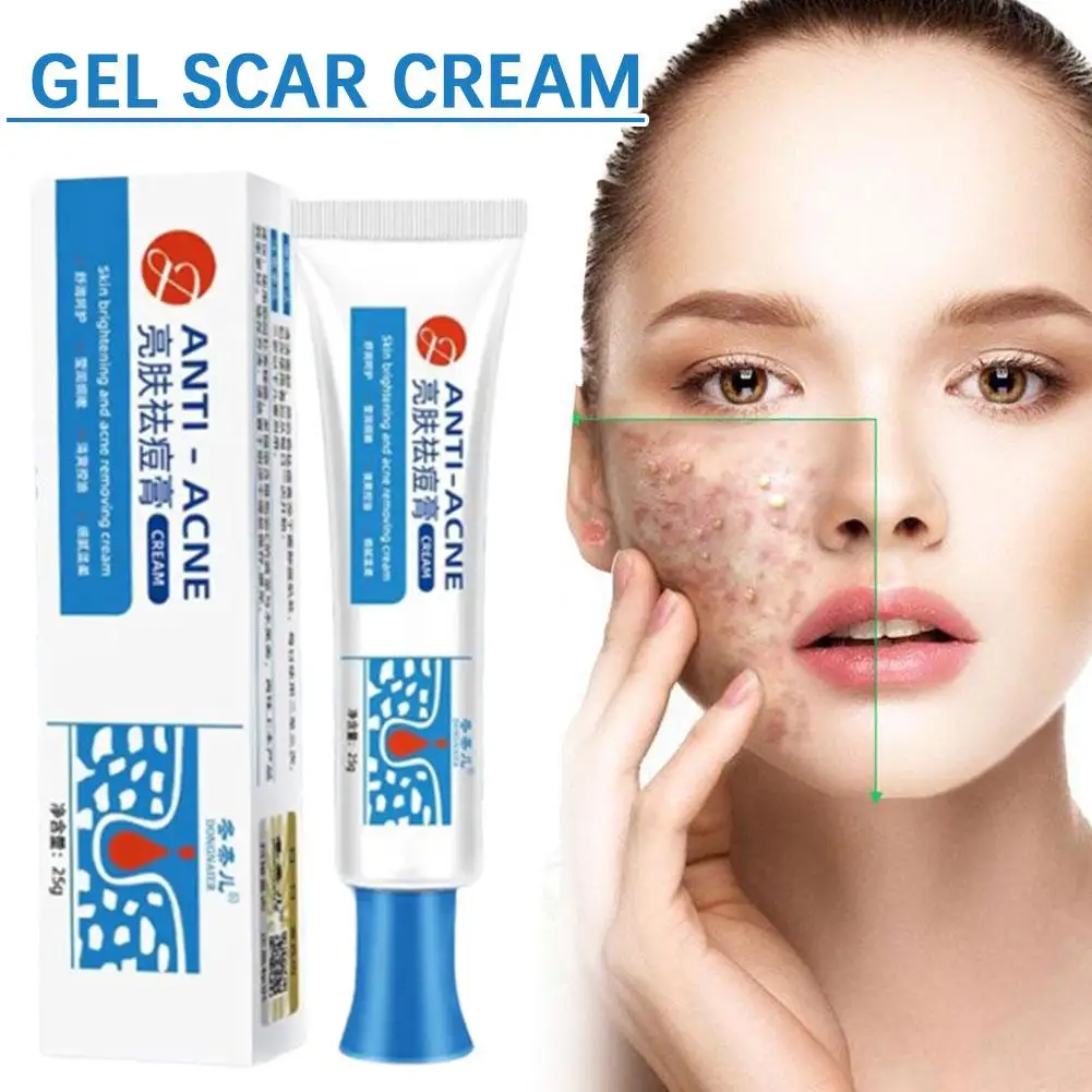 1/3/5 pçs remoção de acne creme facial natural acne beleza saúde anti-acne gel espinha remoção de manchas rosto cuidados com a pele suave sem estimulação