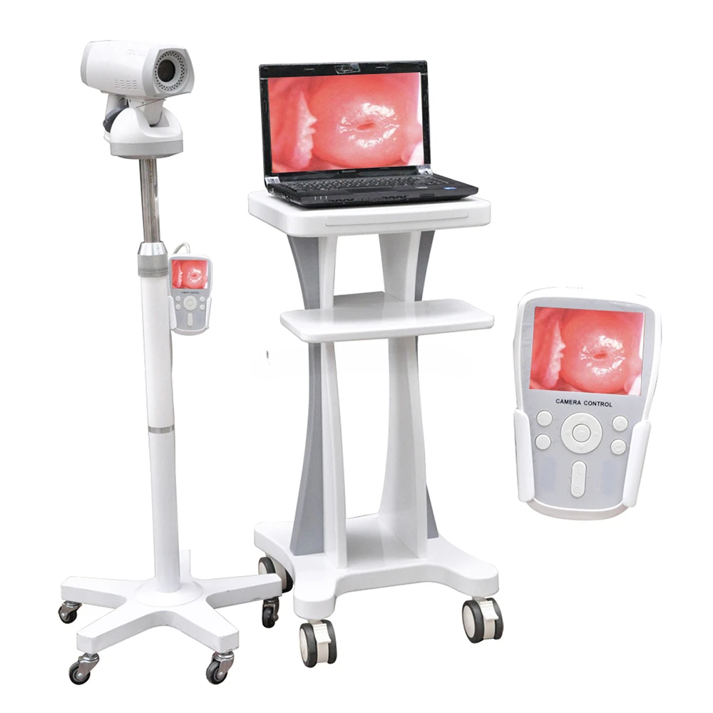 For LH9800A Mobile Examination Obstetrics Gynecology Video Gynecological Obstetric Machine for Woman Colposcopy Equipment