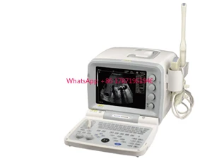 KX2000G Vet Portable Ultrasound Machine with Convex Probe Dhlshipping