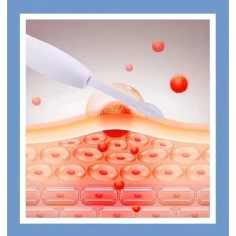 حار بيع 14 في 1 الماس تقشير آلة الوجه المياه النفاثة أكوا الوجه فراغ العناية بالبشرة تنظيف رفع فقاعة سبا