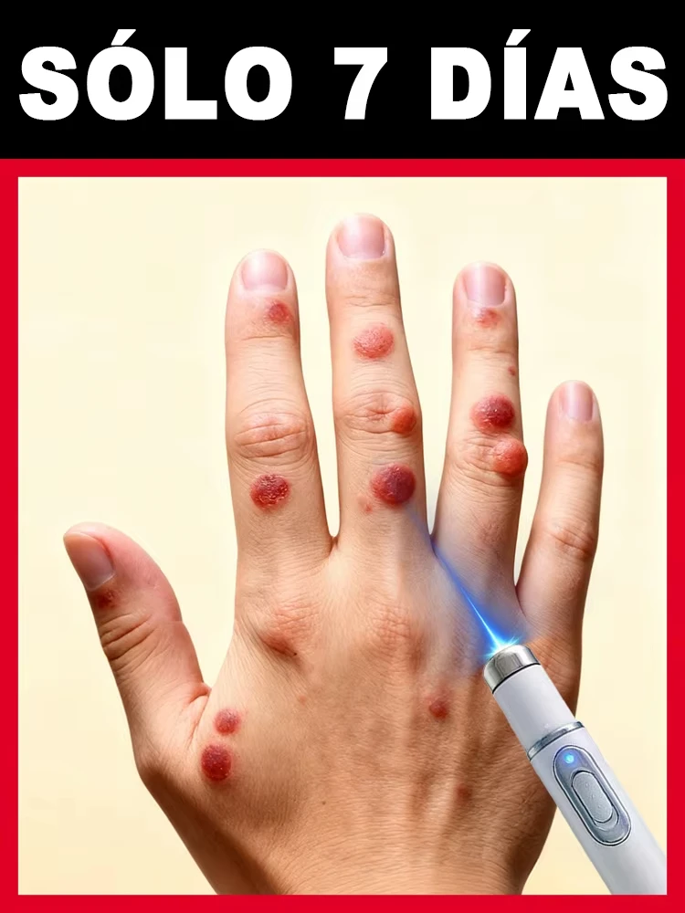 

Portable Blue Light Wart Care Tool - Fast, Painless & Best-Selling! Works on Feet, Shoulders, Neck & Head