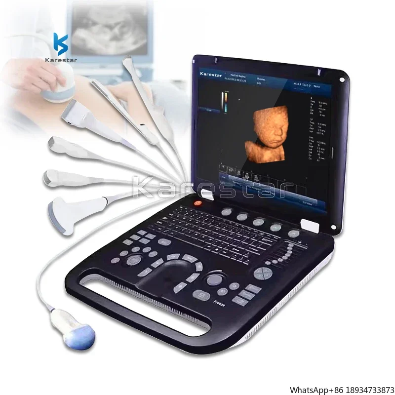 Colour doppler cardiac ultrasound scanner cheapest portable ultrasound machine