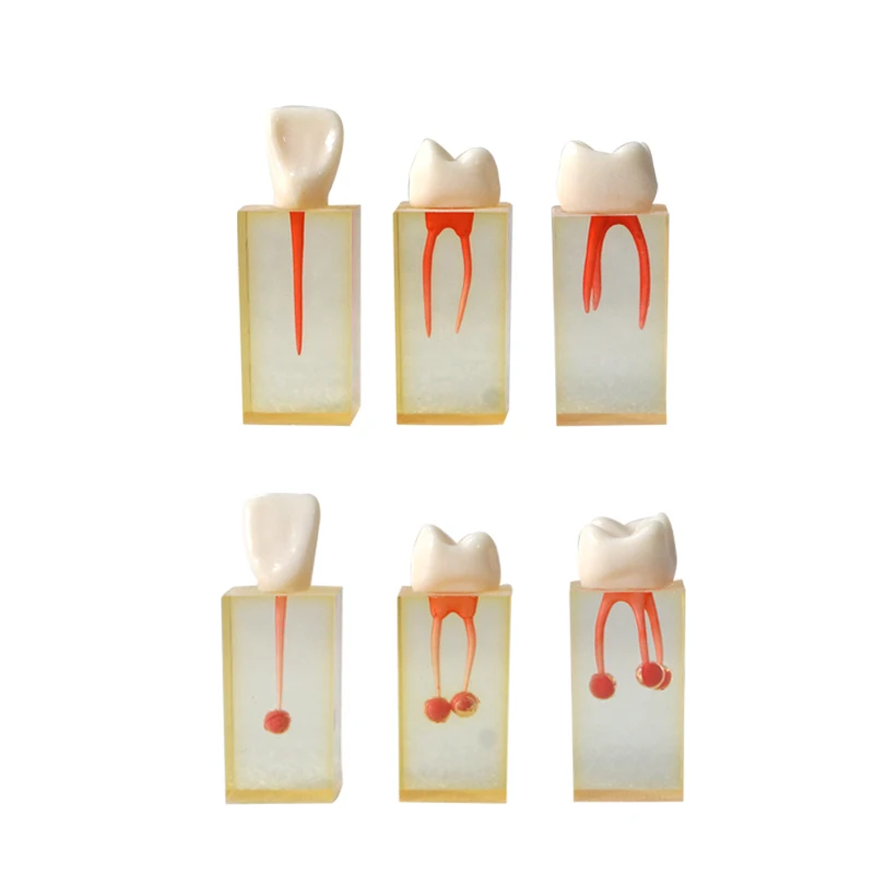 

Dental Training Tooth Root Canal Block Practice Dental Demonstration Tool Dental Model for Dentist Student Learning