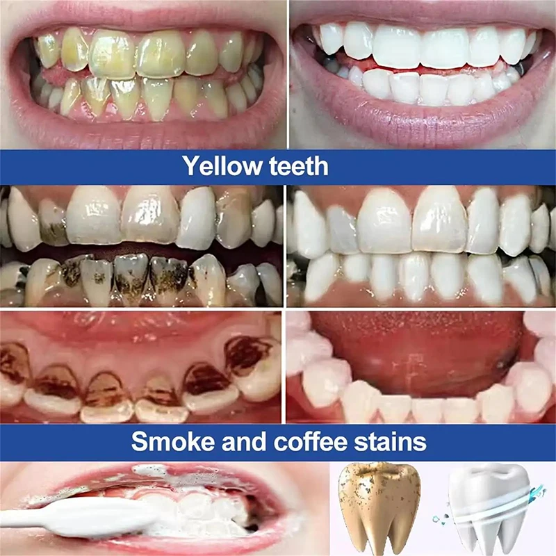 5 Days Teeth Whitening Powder Remove Plaque Stains Dental Calculus Fresh Bad Breath Oral Hygiene Cleaning Tooth Care Products