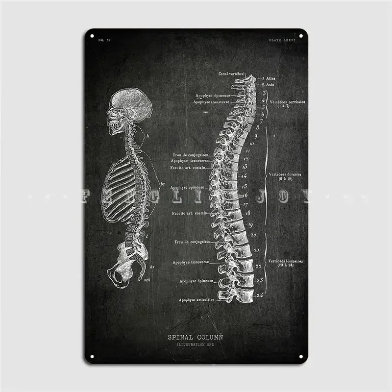 Spinal Column Poster Metal Plaque Club Party Living Room Retro Wall Plaque Tin Sign Poster