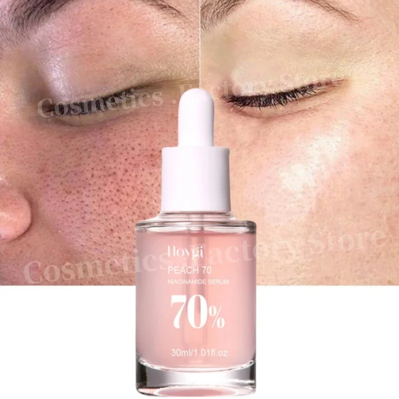 พีช 70% Niacinamide Serum 30ml ป้องกันความแห้งกร้านน้ํามันหอมระเหยบนใบหน้าเพิ่มความยืดหยุ่นเรียบเนียนนุ่ม Skin Care