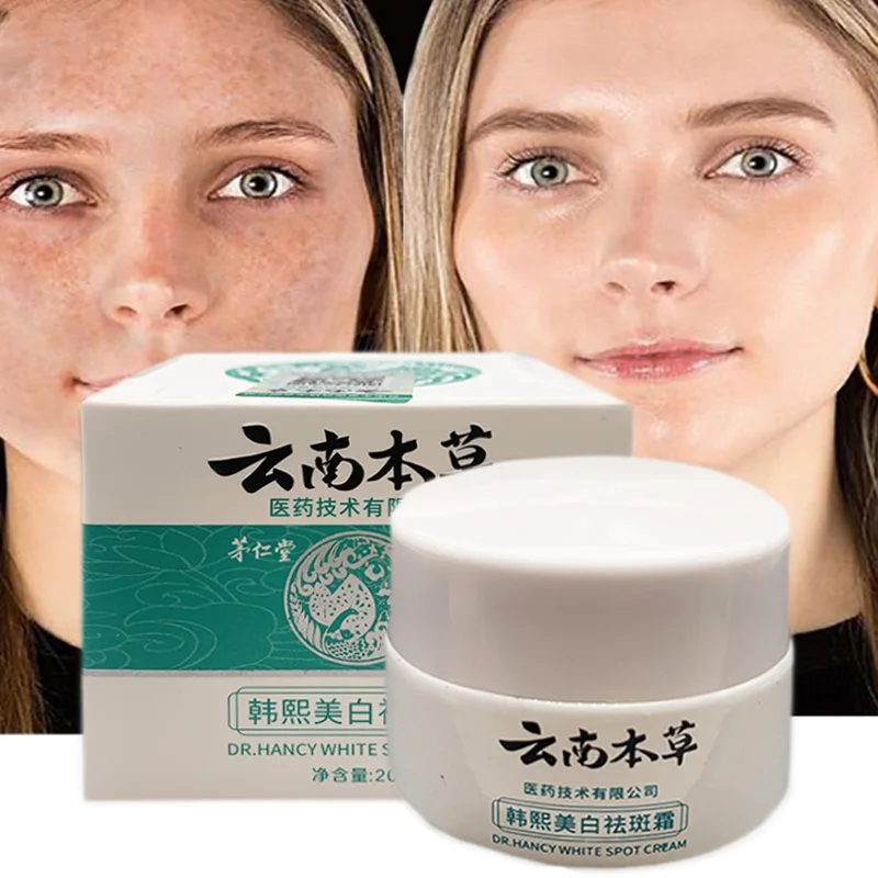 20g Whitening Freckle Cream Effective Remove Melasma Cream Dark Spots Repair Moisturize Brighten Dressing Smooth Face Skin Care