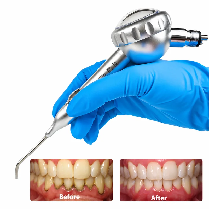 Professional Dental Air Polisher Air Flow Prophy Jet 2/4 Hole Teeth Whitening Cleaning Anti-clog Anti-backflow Autoclavable