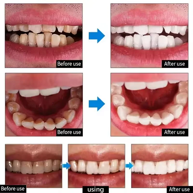 Teeth Whitening Toothpaste Serum Remove Plaque Stains Oral Hygiene Cleaning Dental Bleaching Tools Fresh Breath Tooth Care