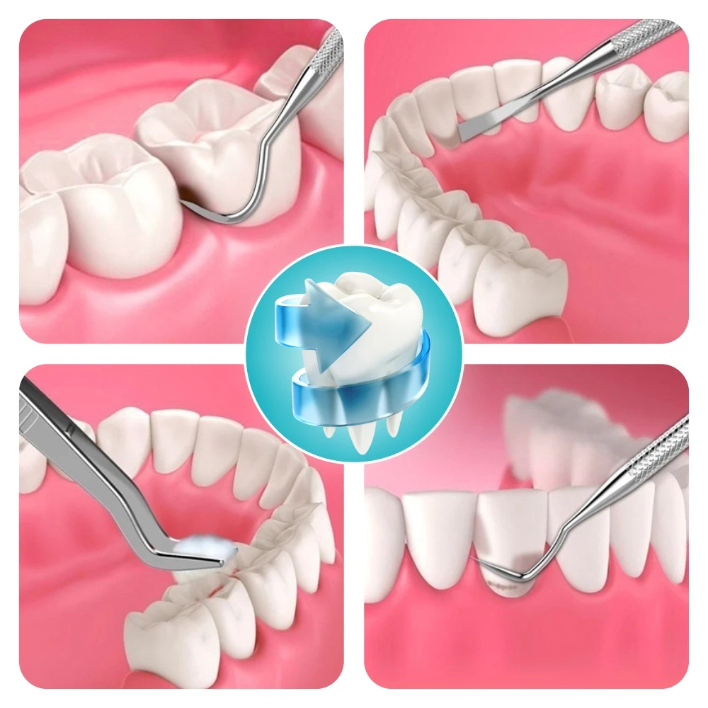 Làm Sạch Răng Bộ Dụng Cụ Gương Nhíp Cuốc Đầu Đo Cói Máy Miệng Nha Khoa Chăm Sóc Inox Cao Răng Loại Bỏ Nha Khoa Dụng Cụ