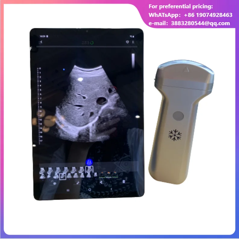 Mini Wireless Portable Ultrasonic Scanner Transductor Convex Transducer Ultrasonic Probe Electric Power Source Made Of Metal