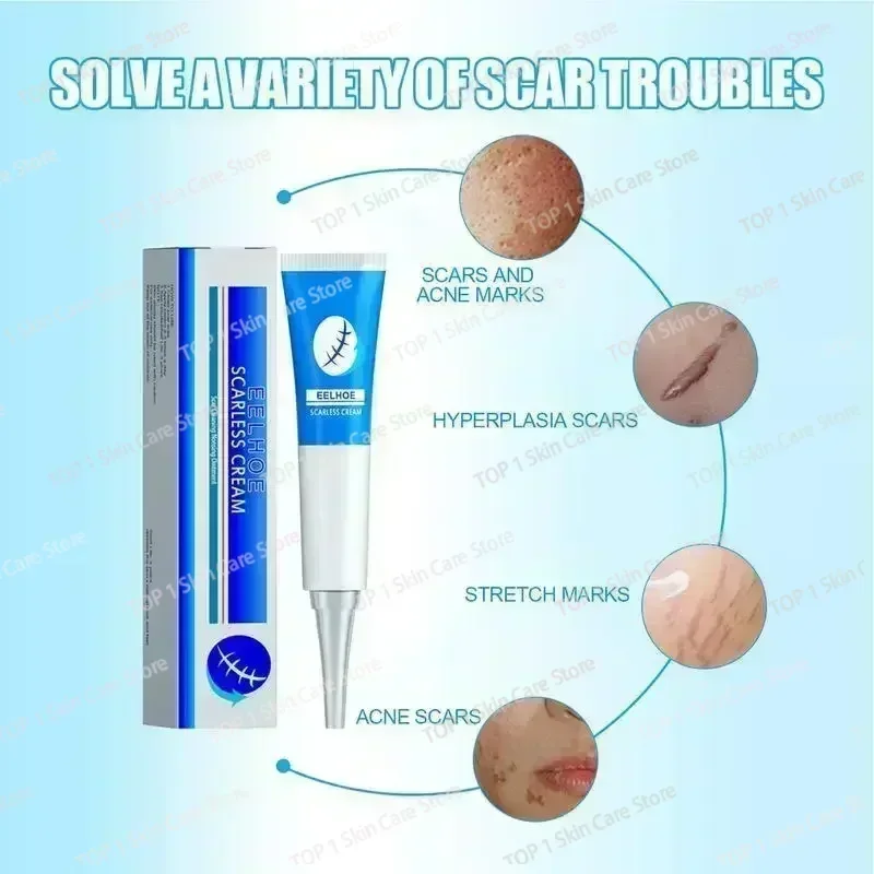 Scar gel effective repair surgical scars stretch marks acne pits pockmarks burn scars repair 1006