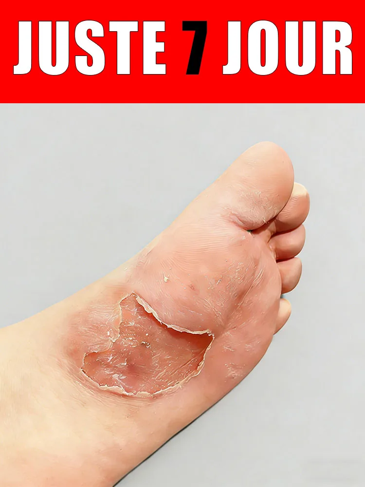 

Rendez chaque чувpe plusohon или плюс удобные, и кайты adieu à l'inconfort.