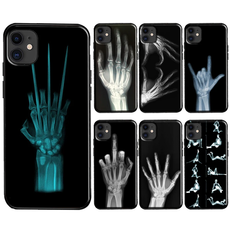 X-ray Hand Bones Case For iPhone 8 6S 7 Plus SE 2020 Cover For iPhone XR X XS 11 12 14 Pro Max 13 mini Coque