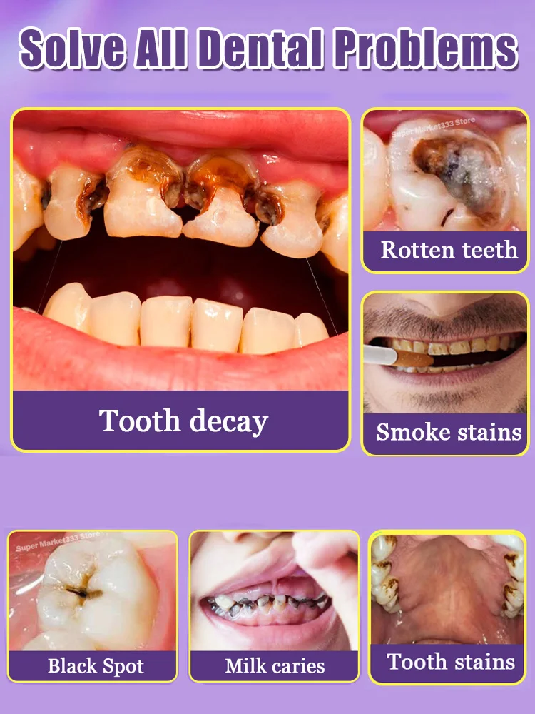 Anti-Cavity Repair Tooth Decay