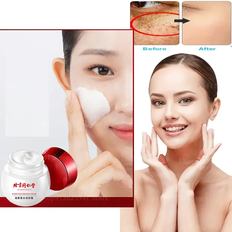 Niacinamide Skin Whitening Day Cream Remove Melasma Acne Spot Pigment Melanin Dark Spots Pigmentation Whitening Cream