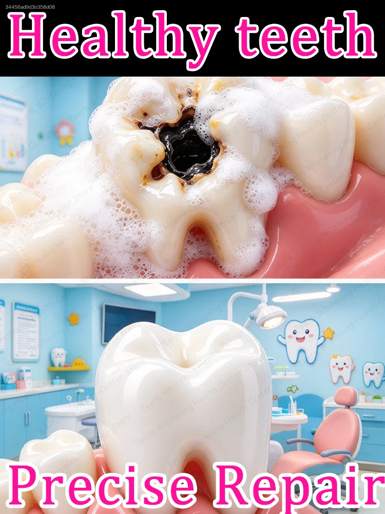 Gentle Whitening Anti Cavity Toothpaste Remove Plaque Prevent Tooth Decay Bright Smile