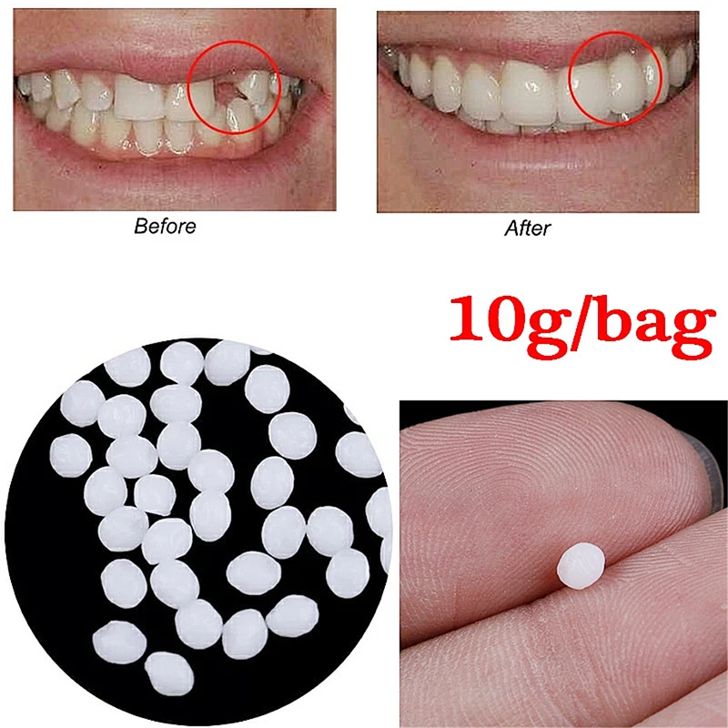 Pasta de gutapercha para restauración Dental, producto para el cuidado Dental, utilizado para relleno de dientes rotos faltantes fijos o pegamento adhesivo para dentaduras postizas, 10g por bolsa