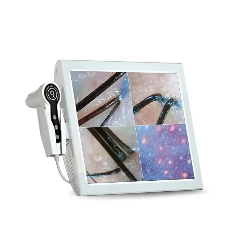 15 inch digital high definition screen, home skin and hair analyzer to help you analyze skin
