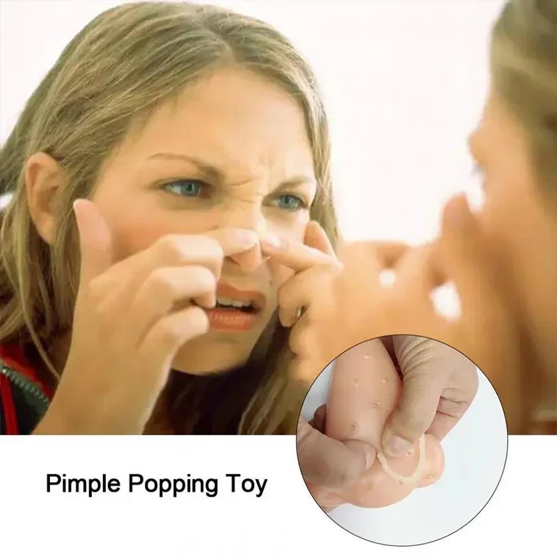 Pimple Toy Nose Toys Squeeze Acne Toys Nose Pimple Popping Stress Relief Novelty Toy Squeeze Acne Toy