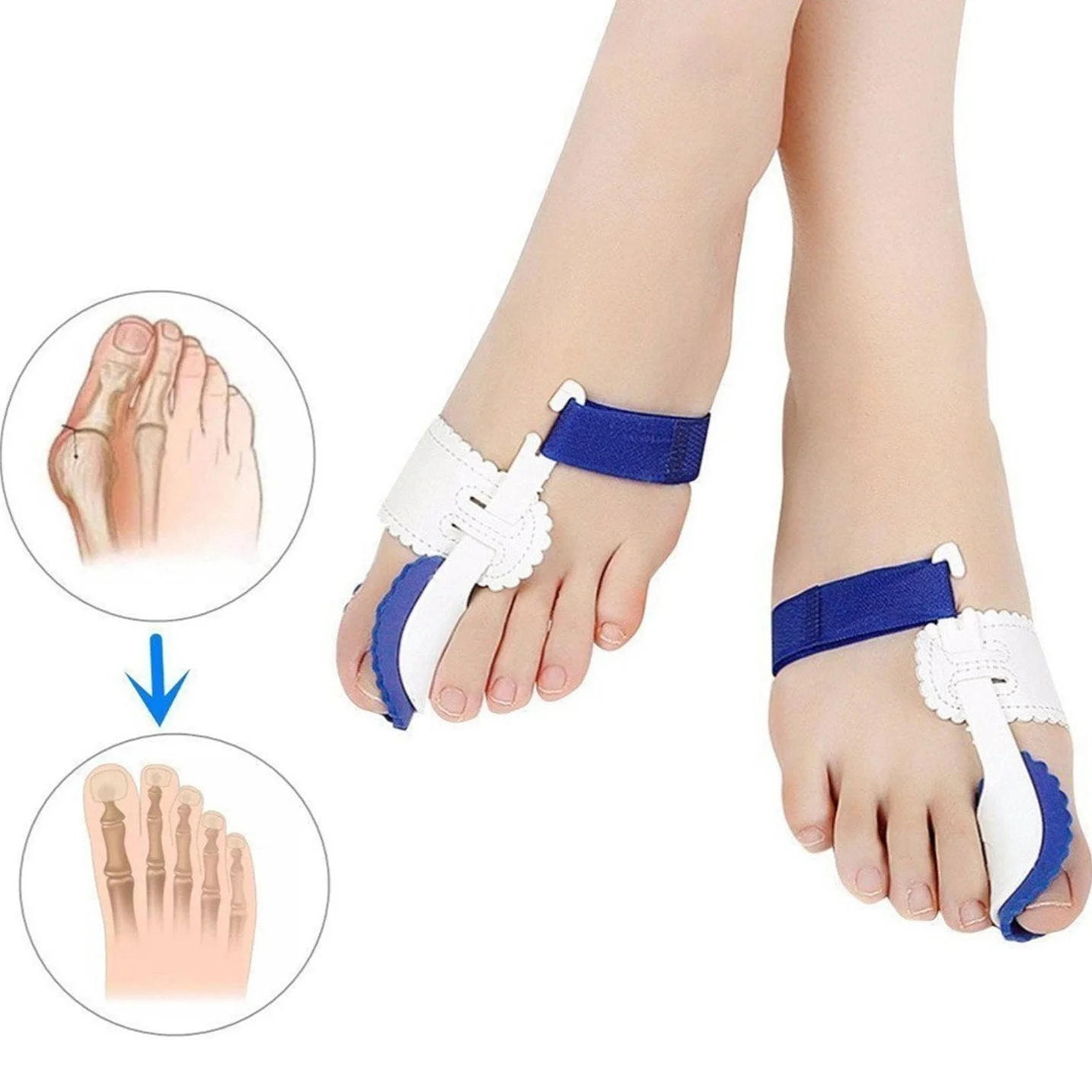 Corrector Foot Orthopedic Pro Tools Bunion Corrector Hallux Valgus Toe Separator Feet Care Thumb Corrector De Juanetes Para Pies